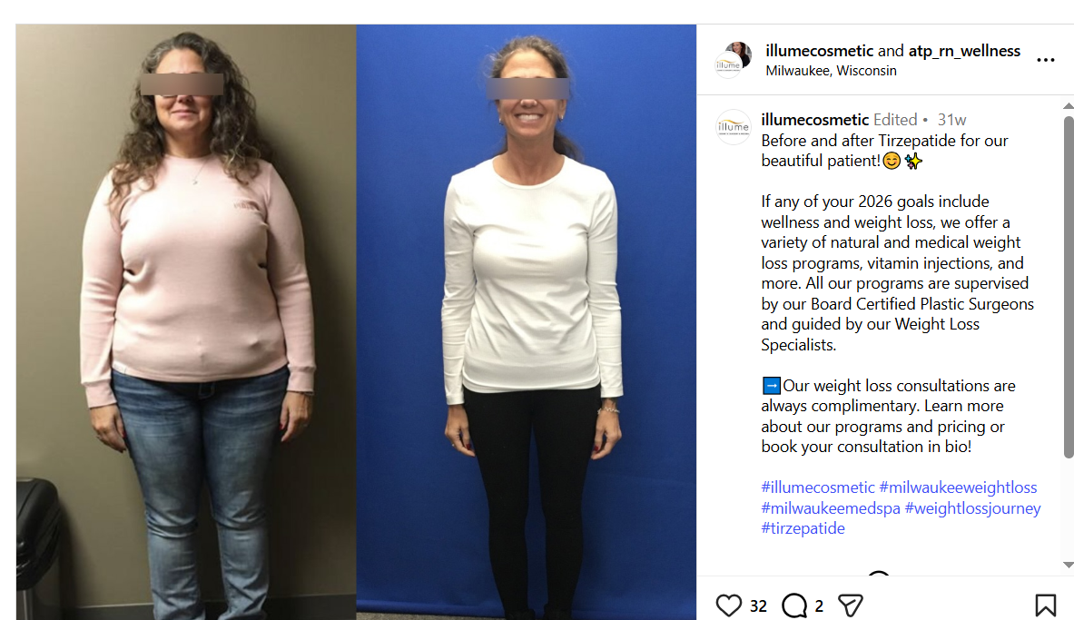 Before and after Tirzepatide for our beautiful patient
