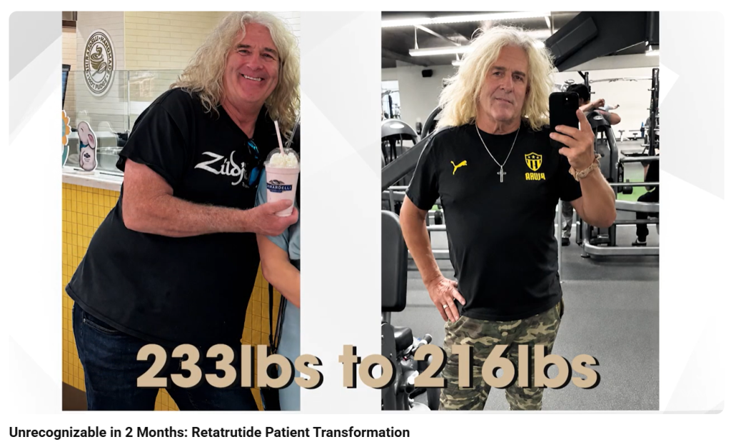 Retatrutide Patient Transformation